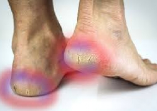 Thembrat e çara mund t’i sheroni me sodë buke