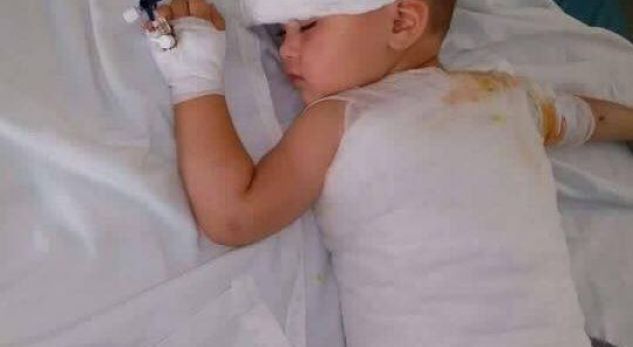 Kjo vogëlushe po lufton me vdekjen, 2-vjeçarja ka nevojë për ndihmë