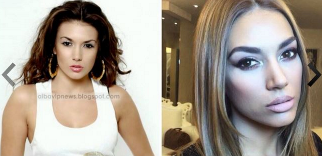 FOTOT/ Nuk do ta besoni, por ja si janë transformuar ndër vite këngëtaret shqiptare