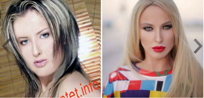 FOTOT/ Nuk do ta besoni, por ja si janë transformuar ndër vite këngëtaret shqiptare