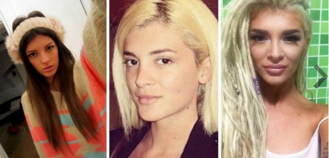 FOTOT/ Nuk do ta besoni, por ja si janë transformuar ndër vite këngëtaret shqiptare