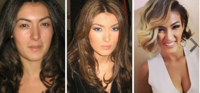 FOTOT/ Nuk do ta besoni, por ja si janë transformuar ndër vite këngëtaret shqiptare