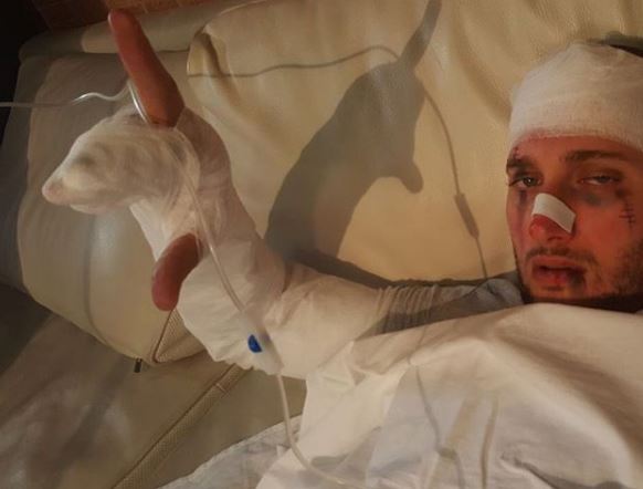 ‘Bëni një nuselale dhe 2 salçiçe’, aktori i Portokallisë mesazh nga ‘spitali’