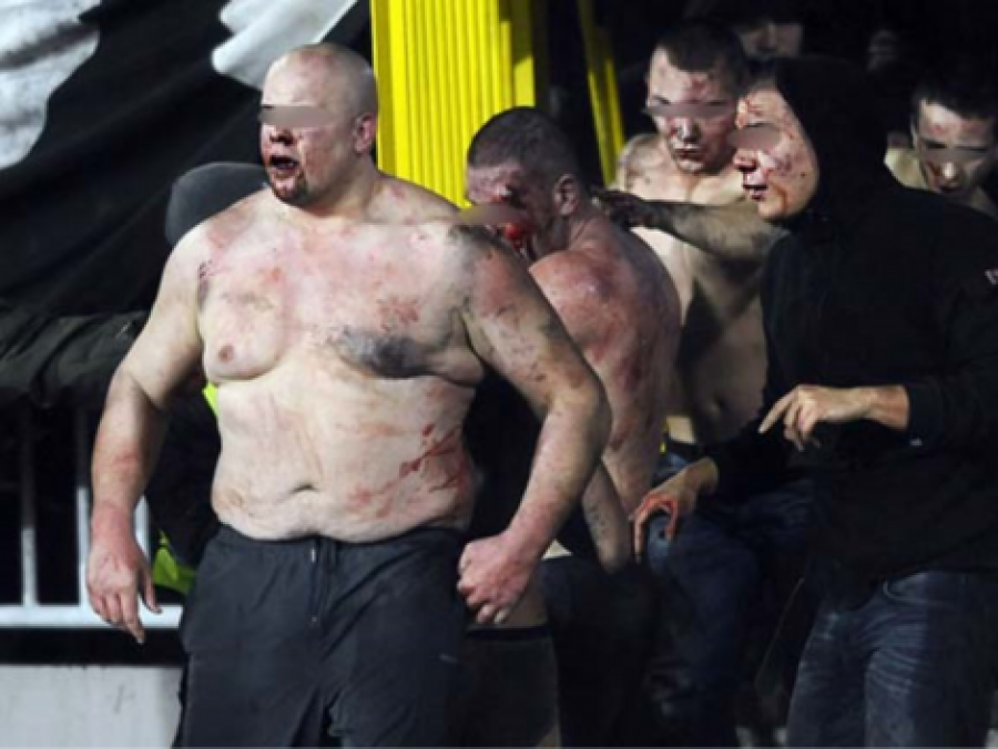 Derbi Crvena-Partizan nuk zhgënjen. Përleshje e përgjakshme masive