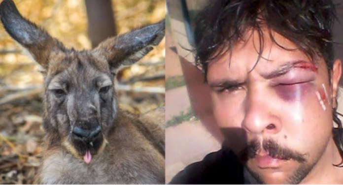 Kanguri bën për spital gjahtarin, thyen xhamin e makinës dhe i bën copë nofullën