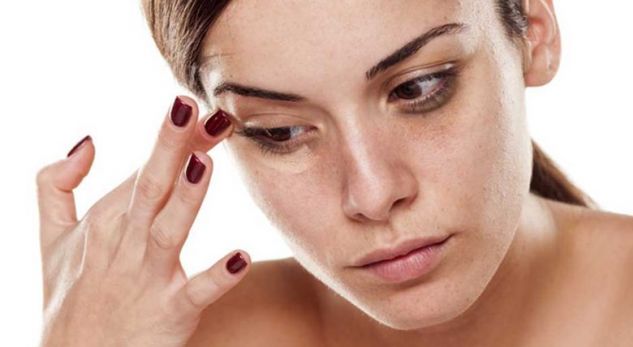 ‘Ilaçi’ natyral, ja si të eliminoni rrathët e zinj poshtë syve