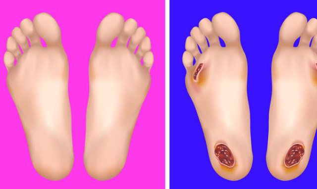 Këmbët tuaja mund t’u tregojnë për 5 sëmundje, lexoni disa fakte