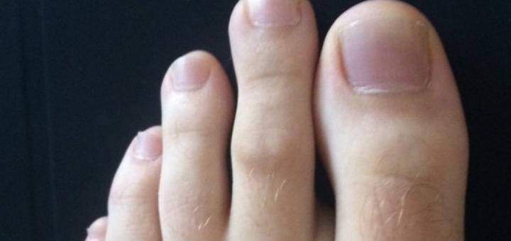 E keni gishtin e dytë më të gjatë? Ja çfarë do të thotë