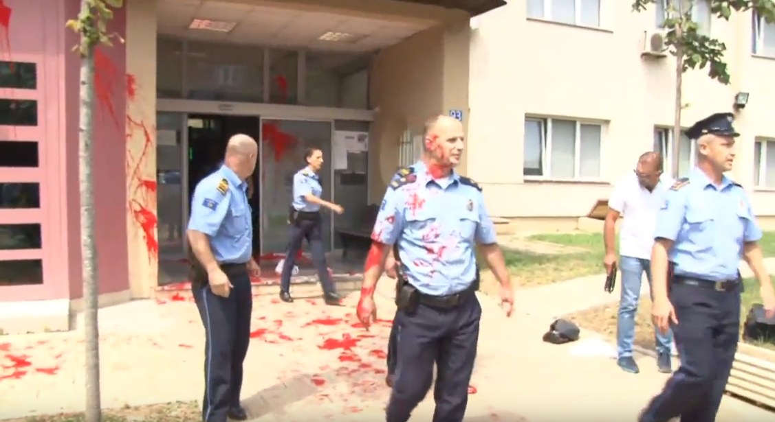 Aktivistët e VV ‘gjakosin’ policët në Kosovë (FOTOT)