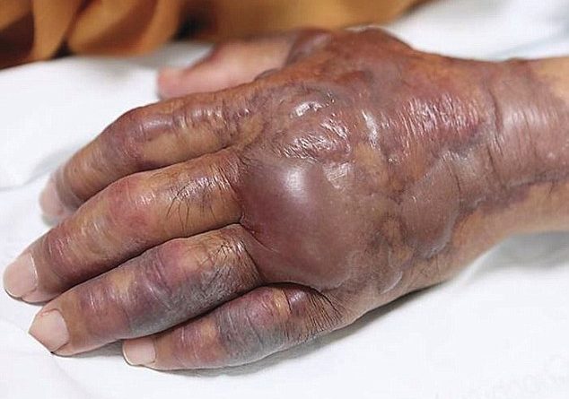 FOTO/ Burrit i presin krahun sepse hëngri…sushi