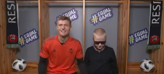 PREKËSE / Vogëlushi i verbër prek fytyrën e Kroos, që të mund ta përfytyrojë