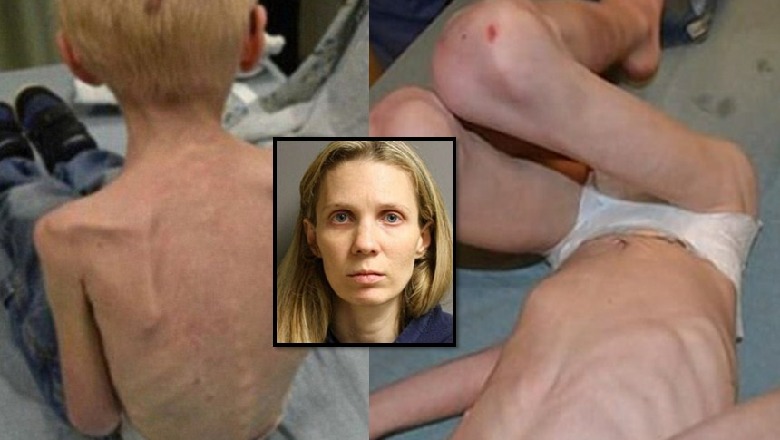 FOTOT/ Njerka mizore dënohet me 28 vite burg, ktheu  5-vjeçarin në kockë e lëkurë