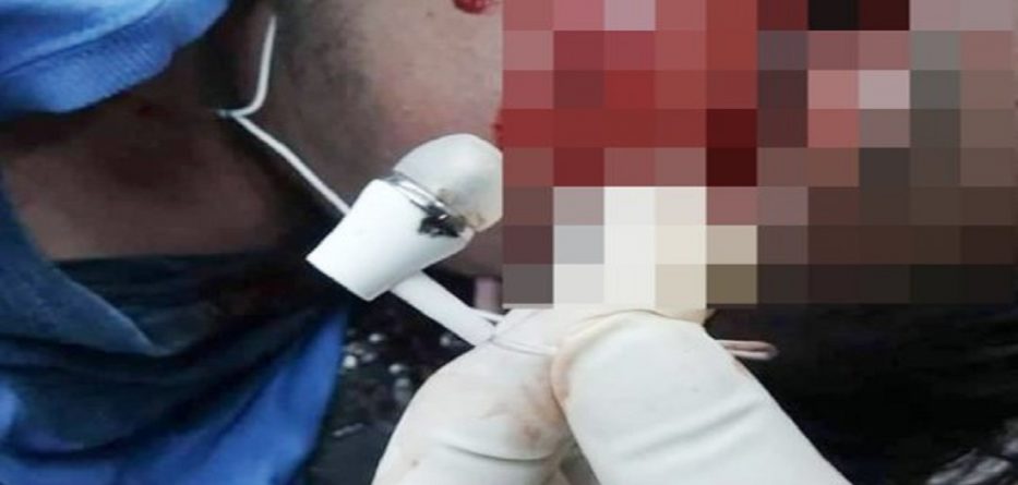 Kujdes nga kufjet, mund t’ju zërë korrenti