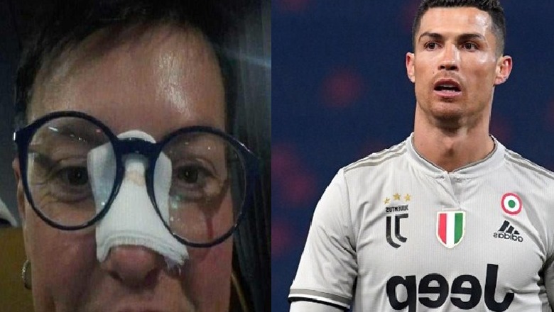 Ronaldo i theu hundën, 46-vjeçarja i bën kërkesën e pazakontë: Më fto për darkë!
