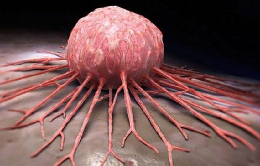 Shkaktarët e kancerit jemi vetë ne, njerëzit?!