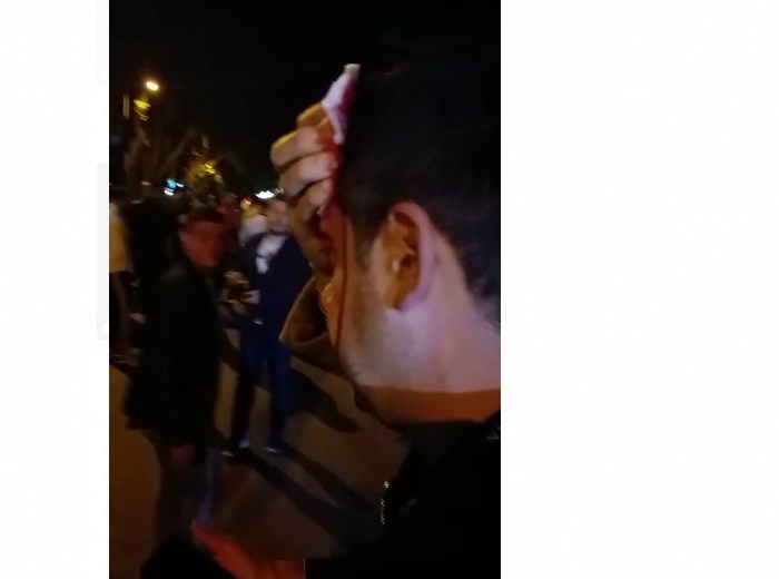 FOTO / Protestuesit e PD gjakosin kameramanin e Top Channel