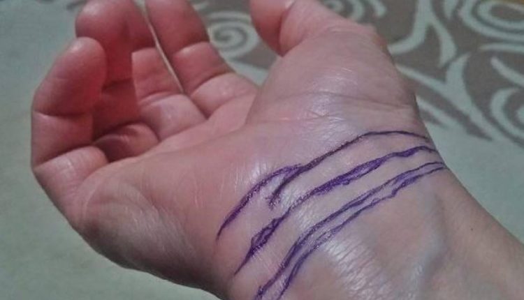 Vijat në kyçin e dorës tregojnë sa gjatë do jetoni