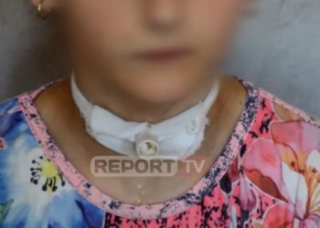 “Dua të jetoj dhe unë si shoqet e mia”, rrëfimi tronditës i 12-vjeçares që merr frymë me anë të një tubi