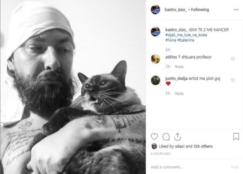 “Kam kancer”, Kastro Ziso trondit publikun me lajmin e keq! E vërtetë?!