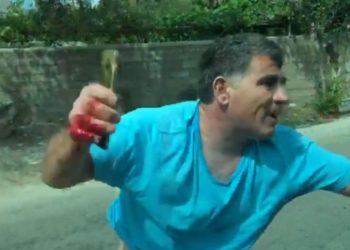 FOTO/ 3 km rrugë mbi makinë dhe gjak e britma, ky është pronari i lokalit që dhunoi turistët