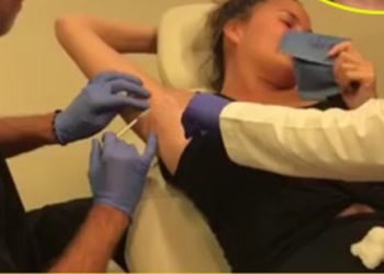 Botox edhe nën sqetullat, moda e re ‘çmend’ vajzat (video)