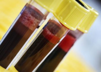 “Do të vdisni brenda 10 viteve të ardhshme”/ Studimi i frikshëm që parashikon me saktësi vdekjen