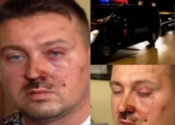 “S’kam probleme me askënd, veç policisë”/ Zbardhet dëshmia e Juxhin Kullës pas atentatit në Korçë