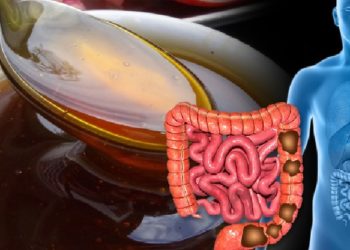 Me këto 5 mënyra të thjeshta shpëtoni nga kapsllëku