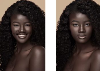 Yll në mediat sociale për shkak të ngjyrës së lëkurës