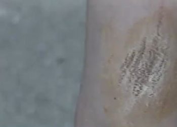 “Tërmeti na shkatërroi shtëpinë”, nëna që u hodh nga ballkoni me djalin e mitur në krah rrëfen tmerrin