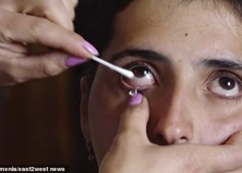 VIDEO+FOTO/ Mjekët shqetësohen për 22-vjeçaren që nxjerr kristal nga sytë në vend të lotit