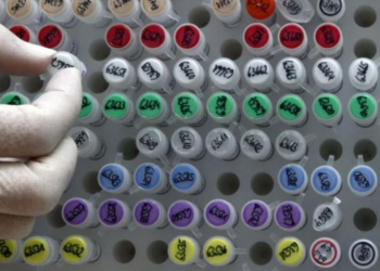 Nuk është zemra vrasësi më i madh në botë, ja sëmundja që po alarmon shkencëtarët