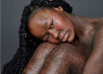 FOTO/ Ndërron lëkurën çdo javë, vajza realizon ëndrrën e jetës: Në kopertinën e “Vogue Italia”