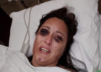 Horror amerikan/ Plor 8 orë tortura bashkëshortes pasi e akuzoi se e gënjeu