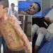 VIDEO+18/ “Babi ndalo djegien të lutem”, Pamjet e tmerrshme tregojnë fëmijët e djegur në Siri
