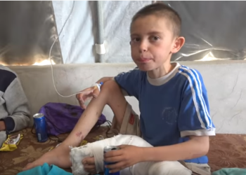 U lirua pas pesë vitesh nga kampi i Sirisë, Alvin Berisha shtrohet në spital