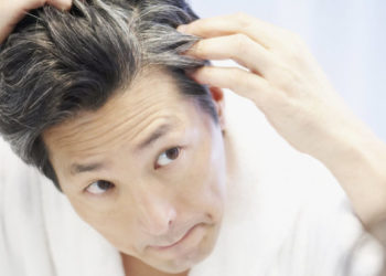 Pesë arsye pse është e rrezikshme ta injoroni shfaqjen e thinjave