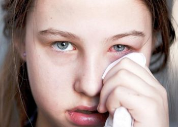 Rikthehet gripi i syrit, okulistja: Nëse nuk trajtohet dëmton shikimin