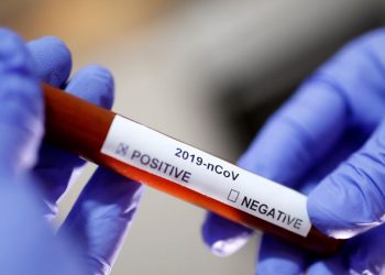 Konfirmohet rasti i parë me koronavirus në Kroaci