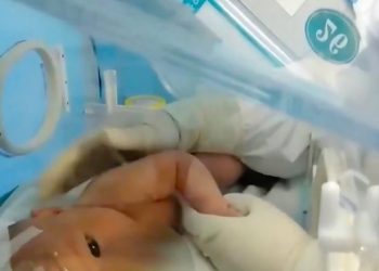 Ndodh mrekullia/ Foshnja e porsalindur e lindur me koronavirus shërohet… pa medikamente