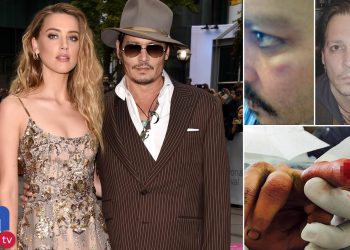 VIDEO+FOTO/ E akuzoi për dhunë, por zbulohet audio si Amber Heard pranon se goditi ish-burrin Johnny Depp