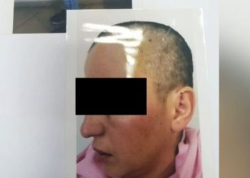 Horrori në Tiranë/ Burri qeth gruan zero, nga frika e ikjes. Babai qeth vajzën adoleshente