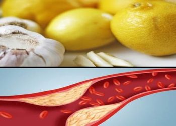 Është një nga kurat më të përdorura/ Pastroni enët e gjakut me hudhër dhe limon