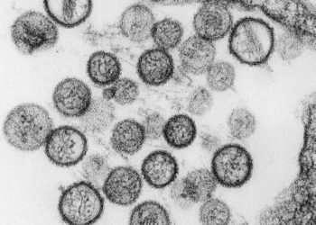 Çfarë është Hantavirus? Ekspertja: Ju lutem mos bëni panik! Nuk është virus i ri, mjafton të mos hani…