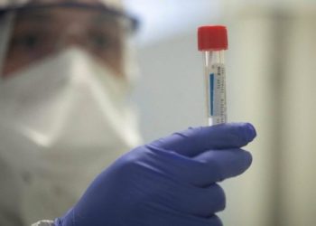 Dy rastet e reja me koronavirus/ Shkon në 5 numri i të infektuarve në Kosovë