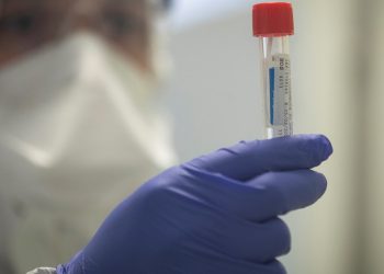 Mjeku: Problemi kryesor që ka një i prekur me koronavirus