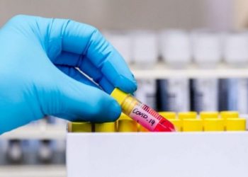 148 të infektuar me koronavirus në Maqedoninë e Veriut, cilat janë qytetet më të prekura