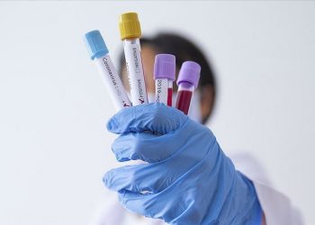 Koronavirusi/ Epidemiologu: Shqipëria i ka kapacitetet për të përballuar situatën