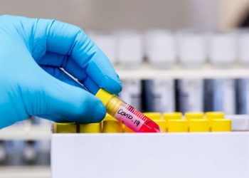 Shtohen rastet në Kosovë, shkon në 35 numri i të prekurve me koronavirus