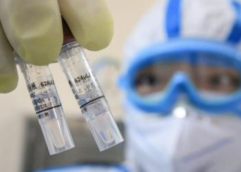 Shtohen frikshëm të prekurit nga koronavirusi, shkon në 107 numri i viktimave në Itali